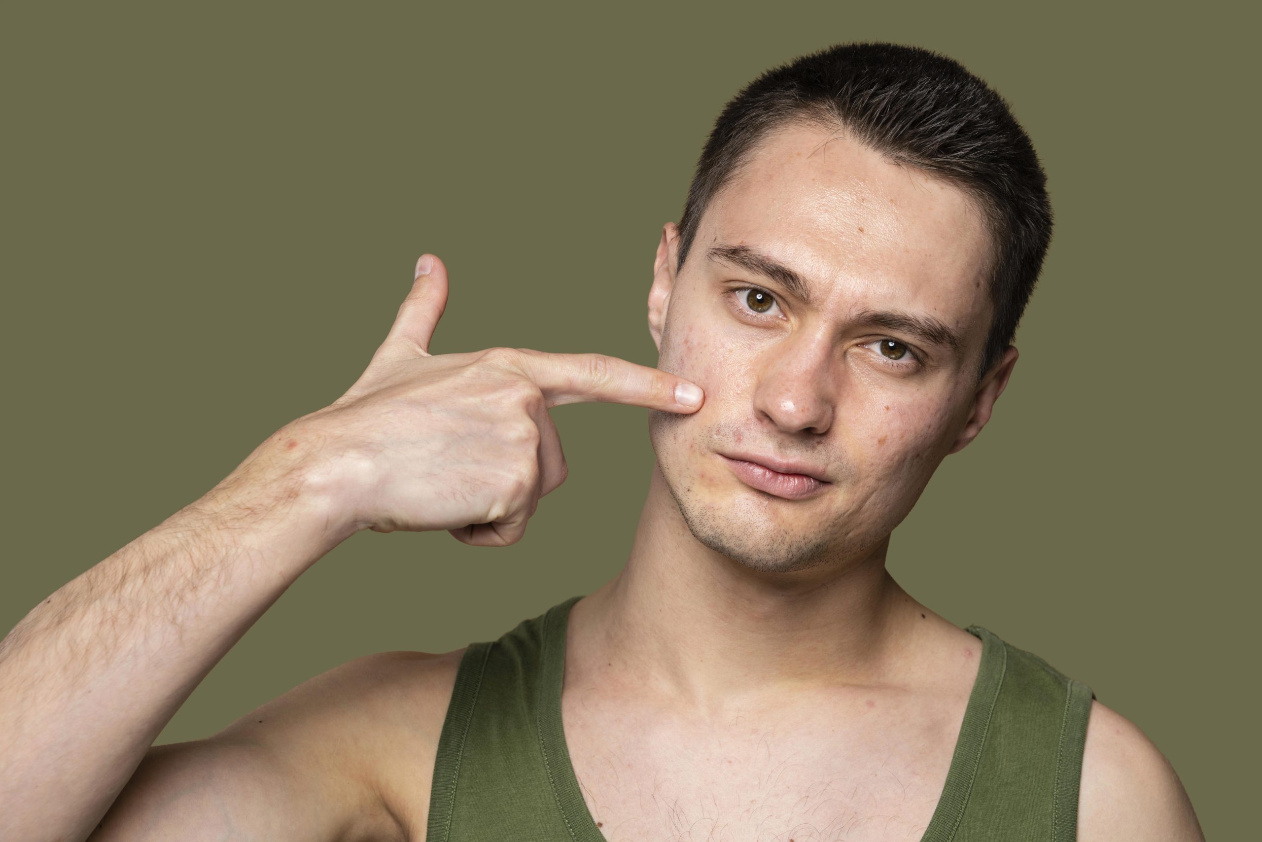 Symptoms of Cellulitis
