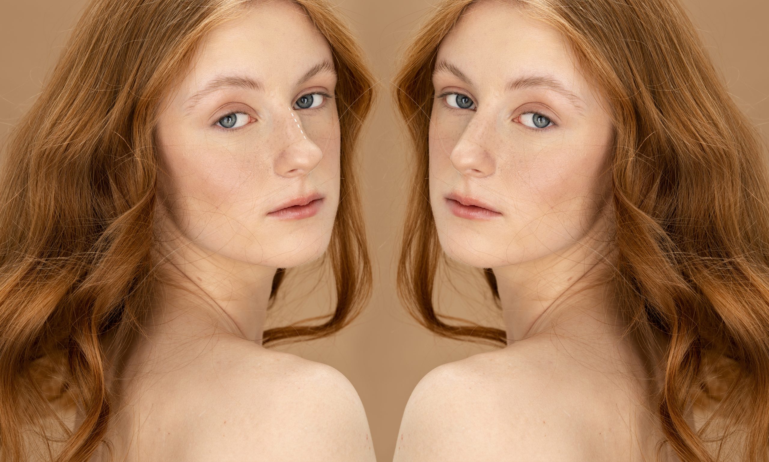 Reduces Redness and Rosacea