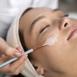 Chemical Face Peel Before and After