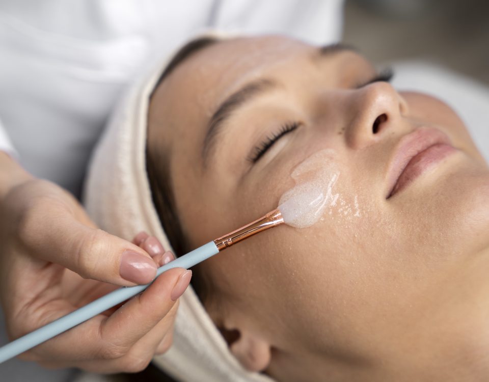 Chemical Face Peel Before and After