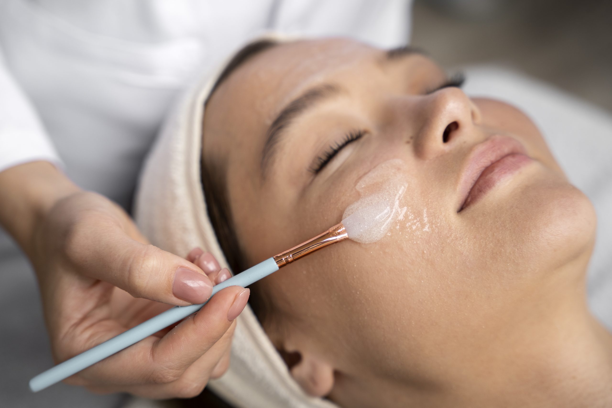 Chemical Face Peel Before and After