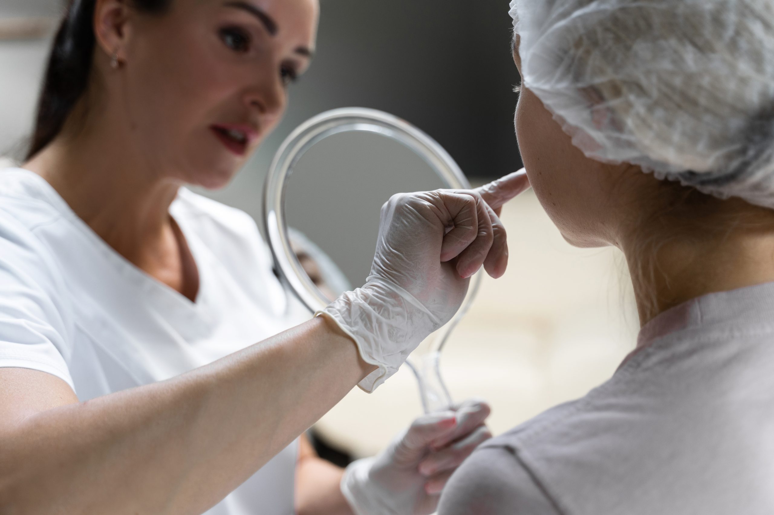 How Does a TCA Chemical Peel Work?