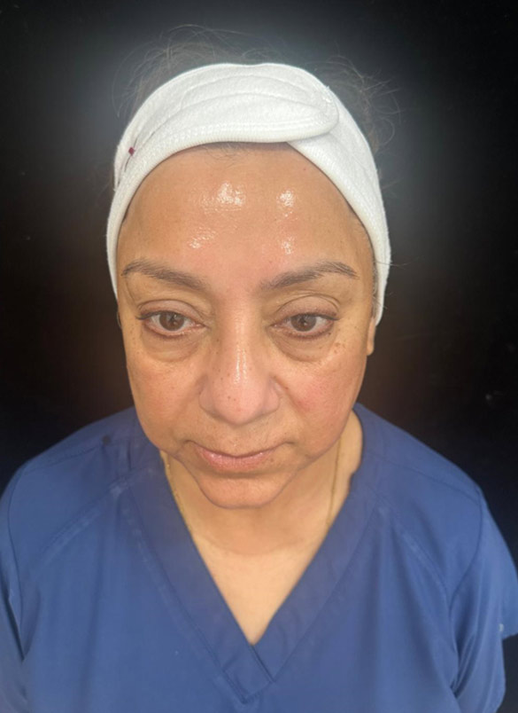 PRX Treatment Near Me in Edgewater, NJ