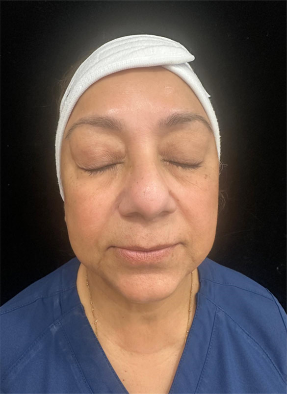 PRX Treatment Near Me in Edgewater, NJ