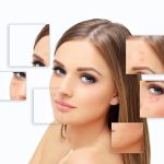 Before and after chemical peel for acne scars at Bergen Premier Aesthetics