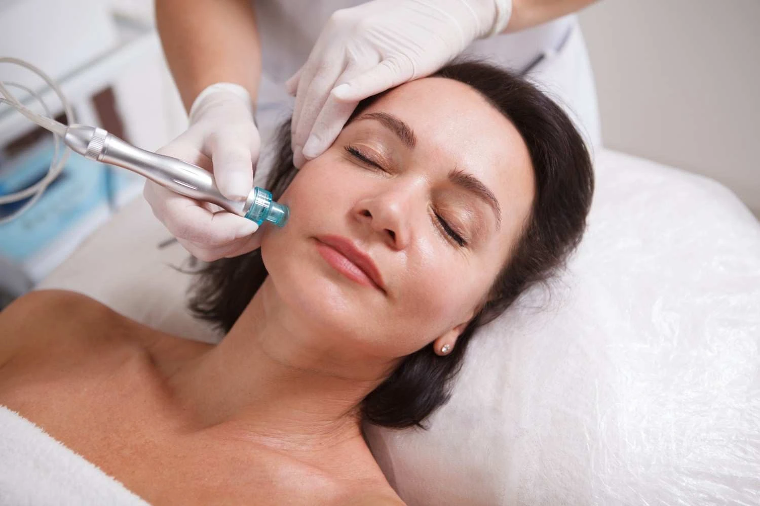 Woman with glowing skin after RF Microneedling in Edgewater, NJ