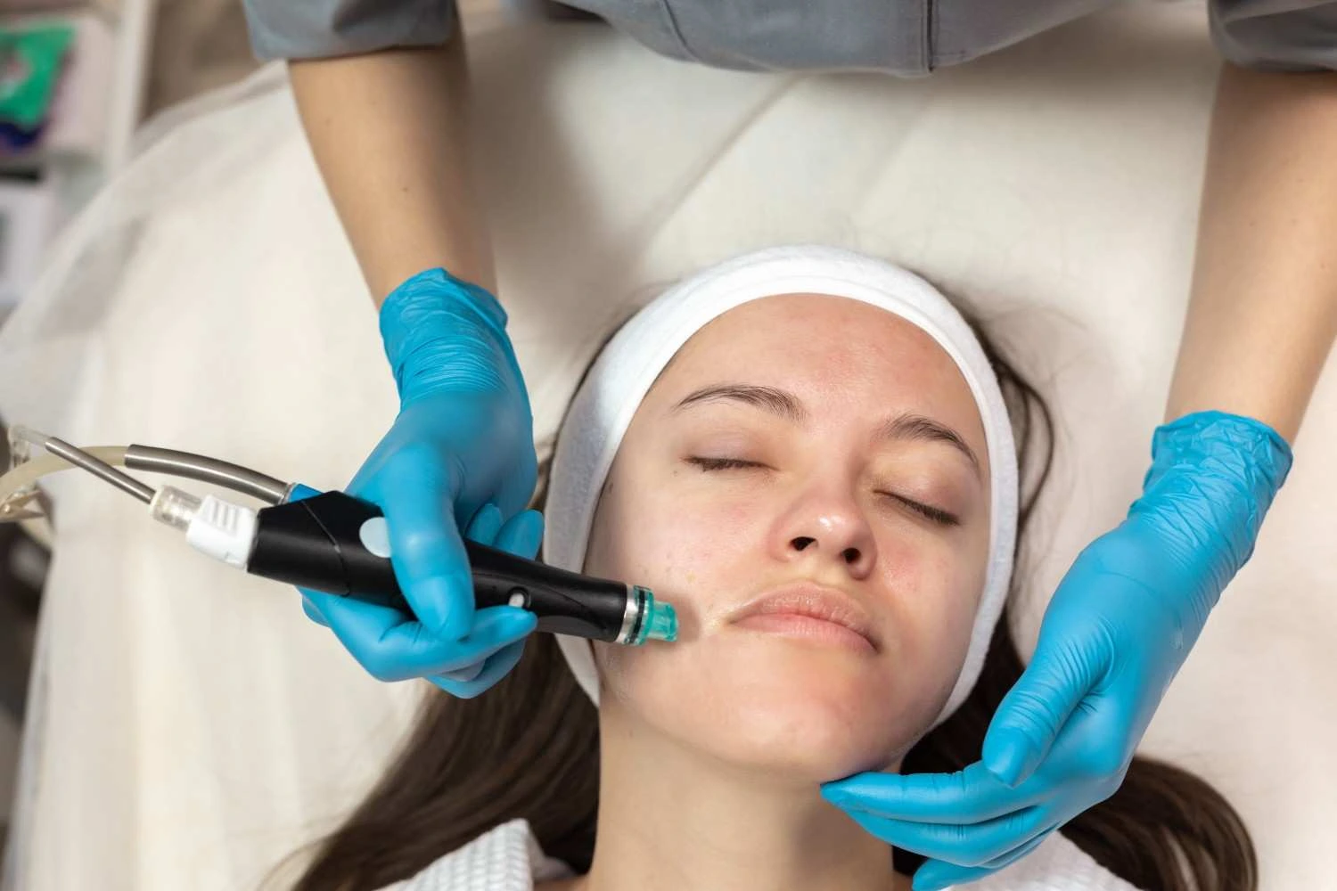 Woman receiving RF Microneedling for fall skin rejuvenation